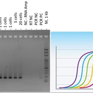 Single-cells transcriptome profile analysis