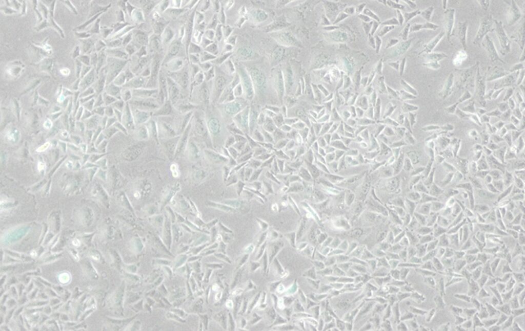 CHO-K1-GFP cells phase contrast white background